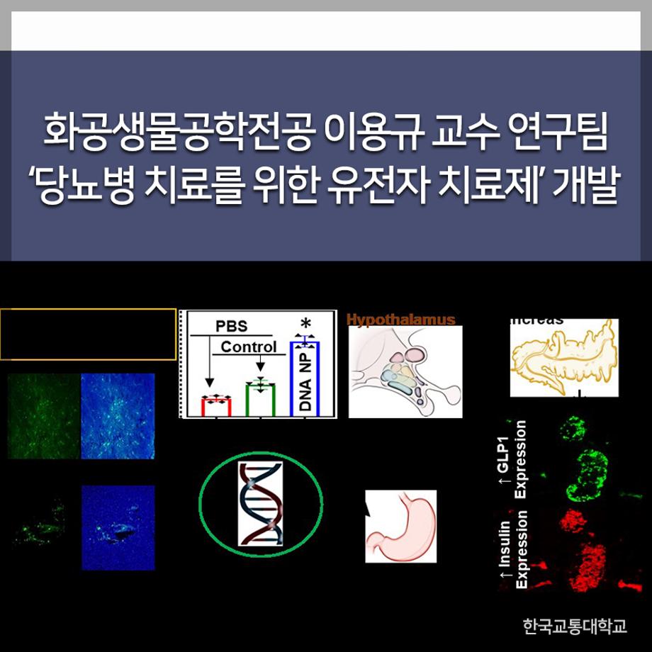 교통대 이용규 교수 연구팀, 당뇨병 치료 위한 유전자 치료제 개발