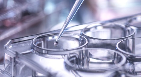 Major in Biotechnology