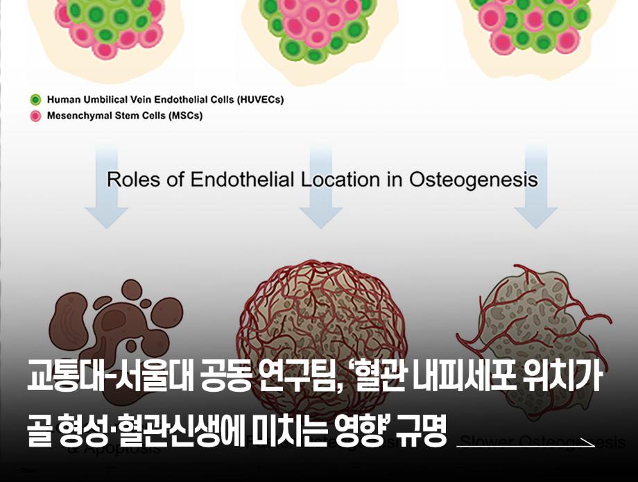 국립한국교통대학교-서울대학교 공동 연구팀, ‘혈관 내피세포 위치가 골 형성 및 혈관신생에 미치는 영향’ 규명