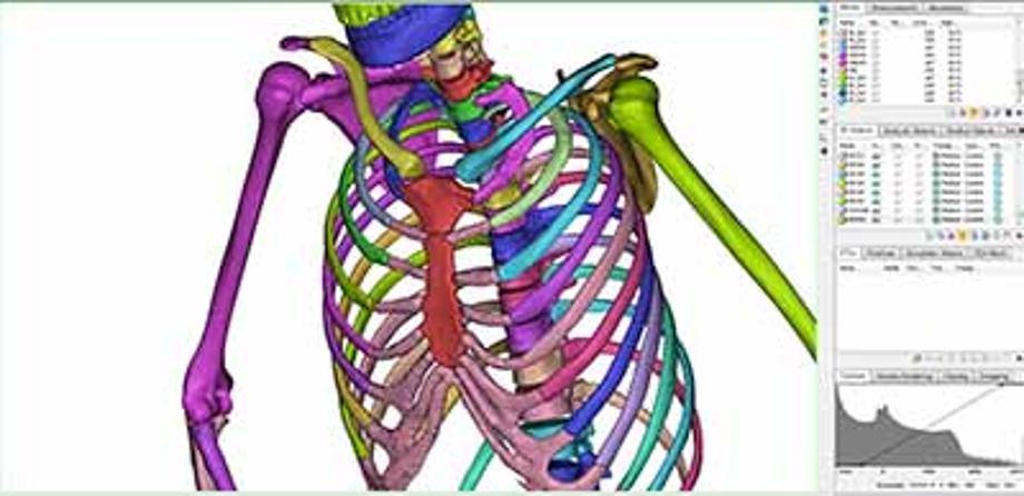 국립 한국교통대학교 3D프린팅센터, 3D프린팅 기술활용 환자맞춤형 의료 Data 제작 실습