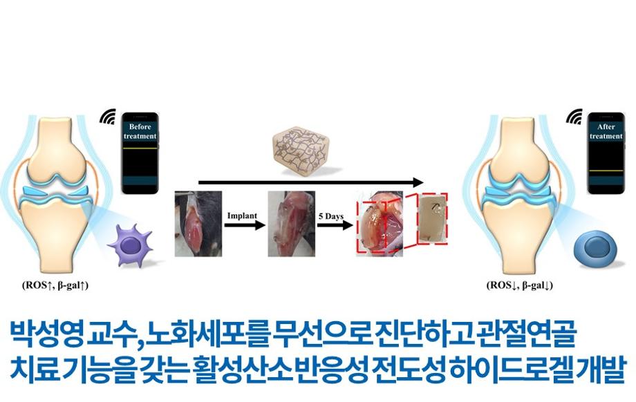 박성영 교수, 노화세포를 무선으로 진단하고 관절연골 치료 기능을 갖는 활성산소 반응성 전도성 하이드로겔 개발